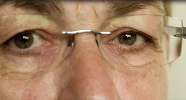 otojh832jiopwn4ypgem41xxk dement