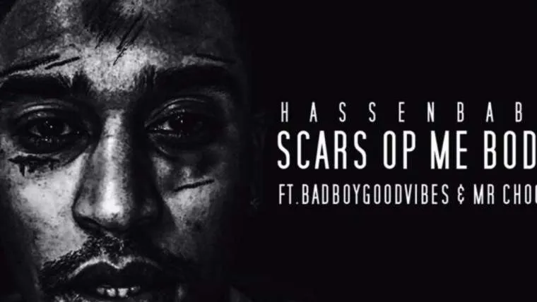 hassenbaba 8211 scars op me body ft badboygoodvibes 038 mr choco