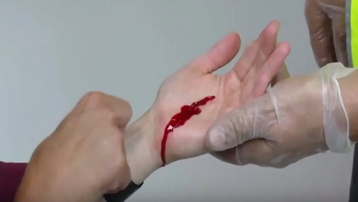 ehbo hand