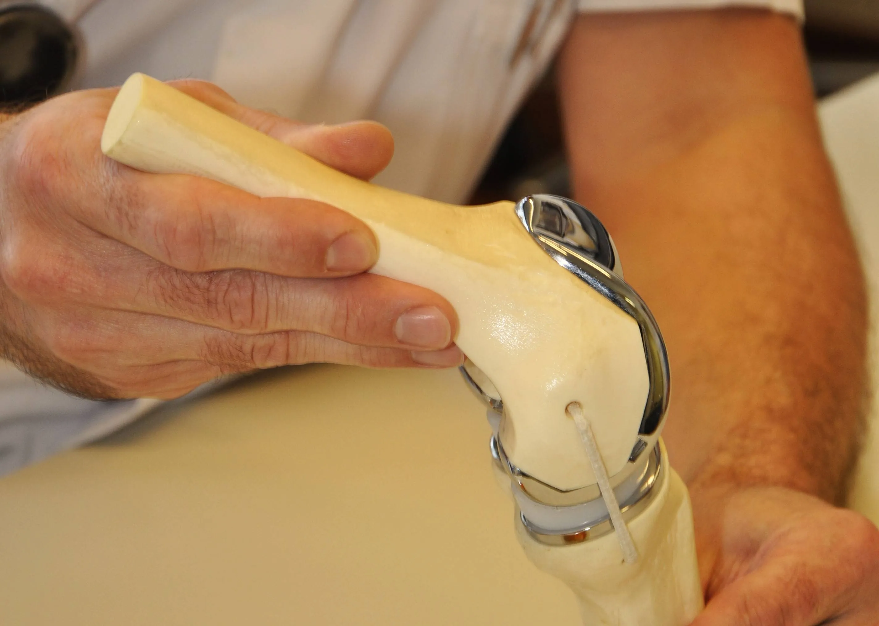 informatieavond artrose