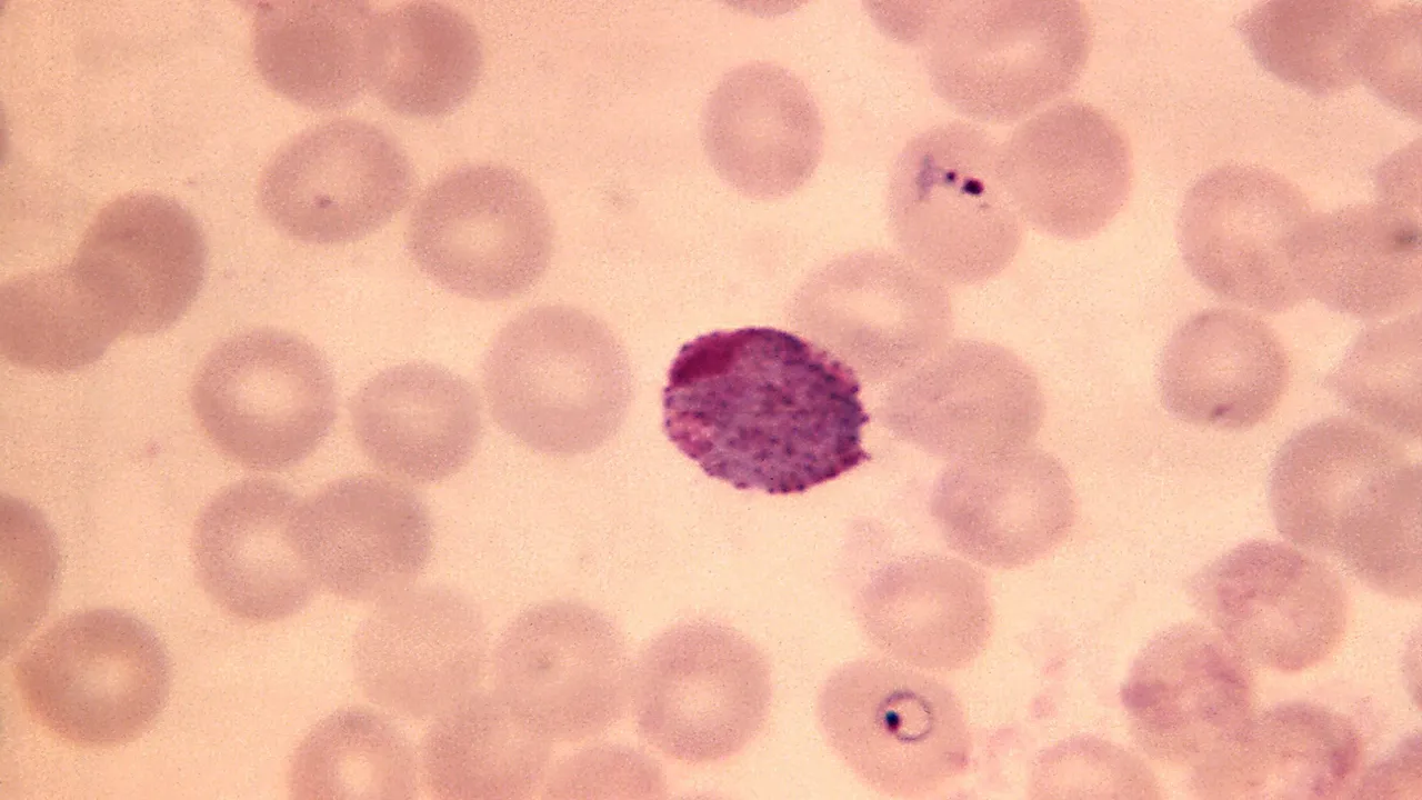 baarmoederhalsuitstrijkje