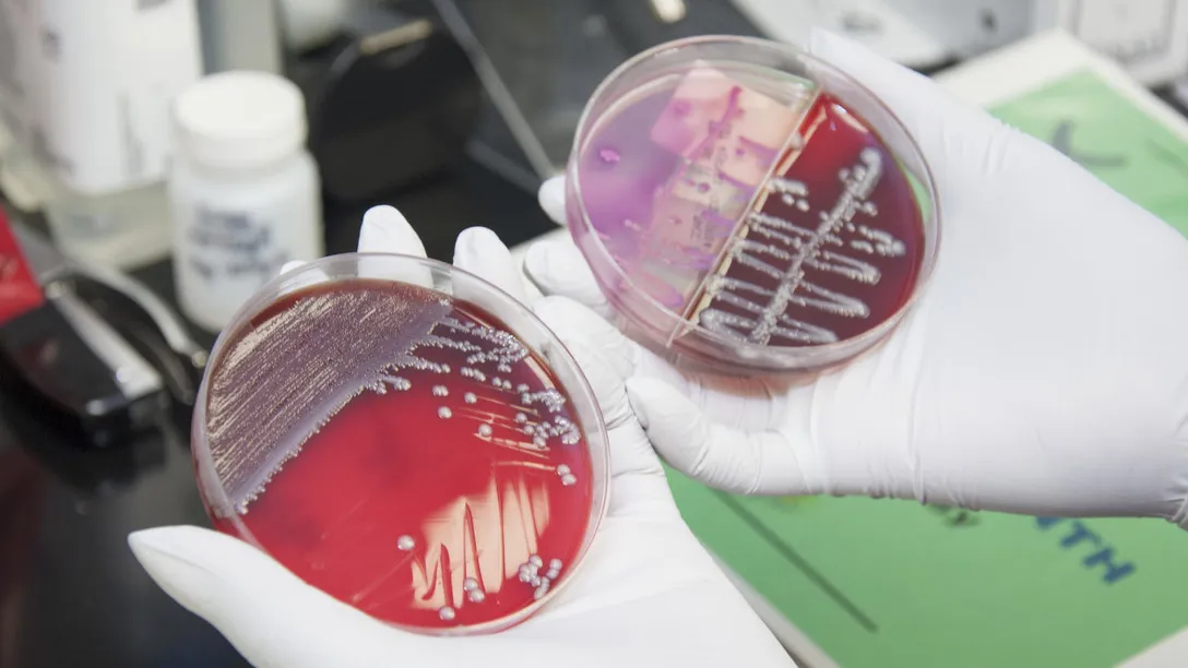 bacteriekweek
