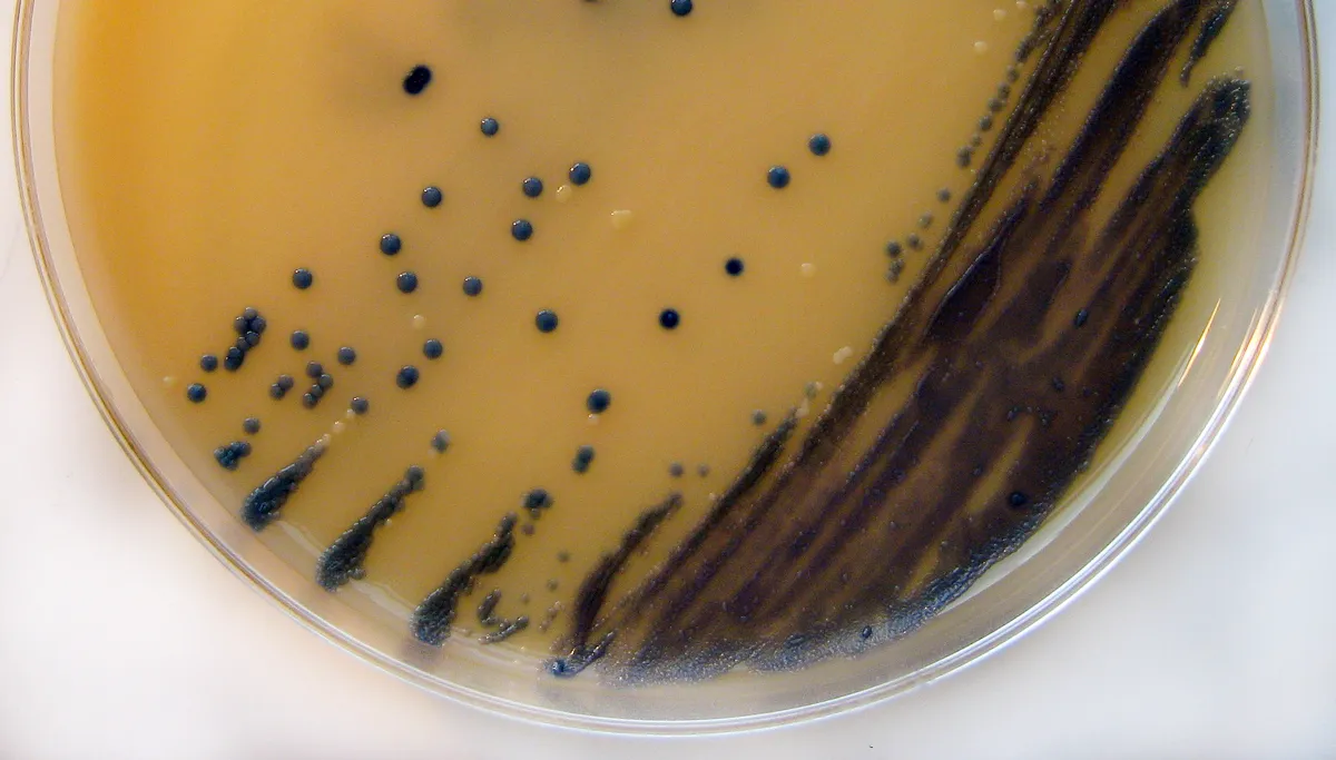 bacterile groei mrsa petrischaal