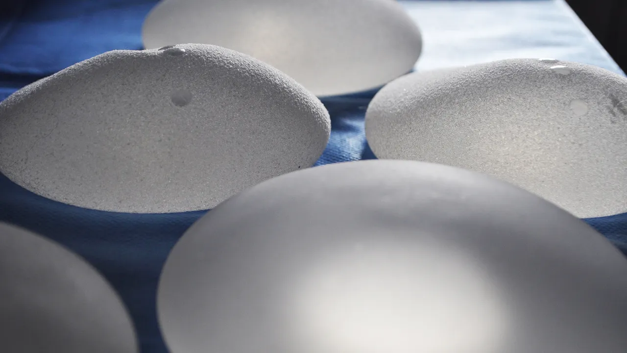 borst implantaten docteur spitalier philippe cc by sa 20 via flickr