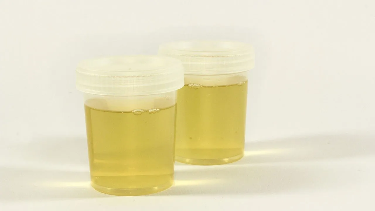 cc0 ewa urban via pixabay urine test