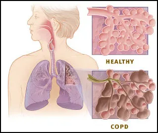 kx9y7fupjav2l90tssjqdi1pl 220707