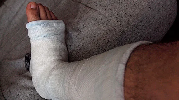 l9dbzp8ktgifaziviaq95iz62 hq gebroken been in gipsverband