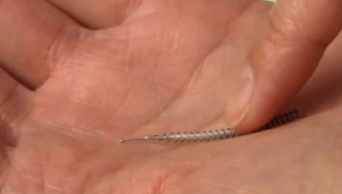 still uit what are essure and adiana tubal occlusions