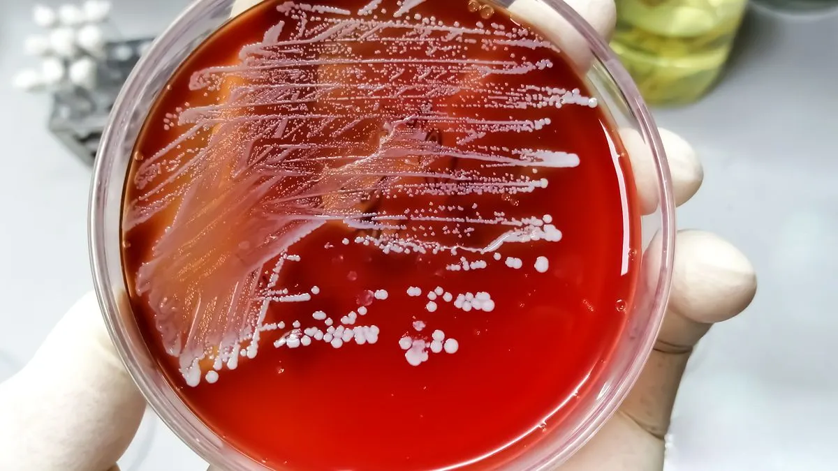 staphylococcus petrischaaltje