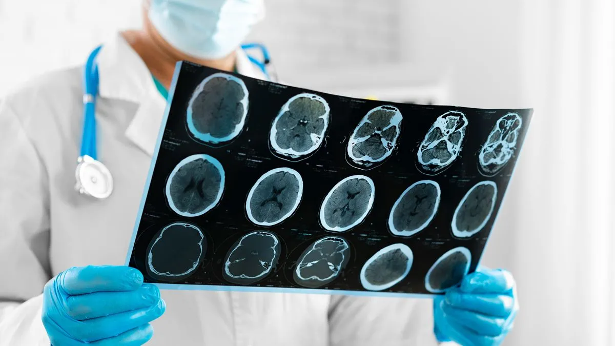 arts uitslag mri scan