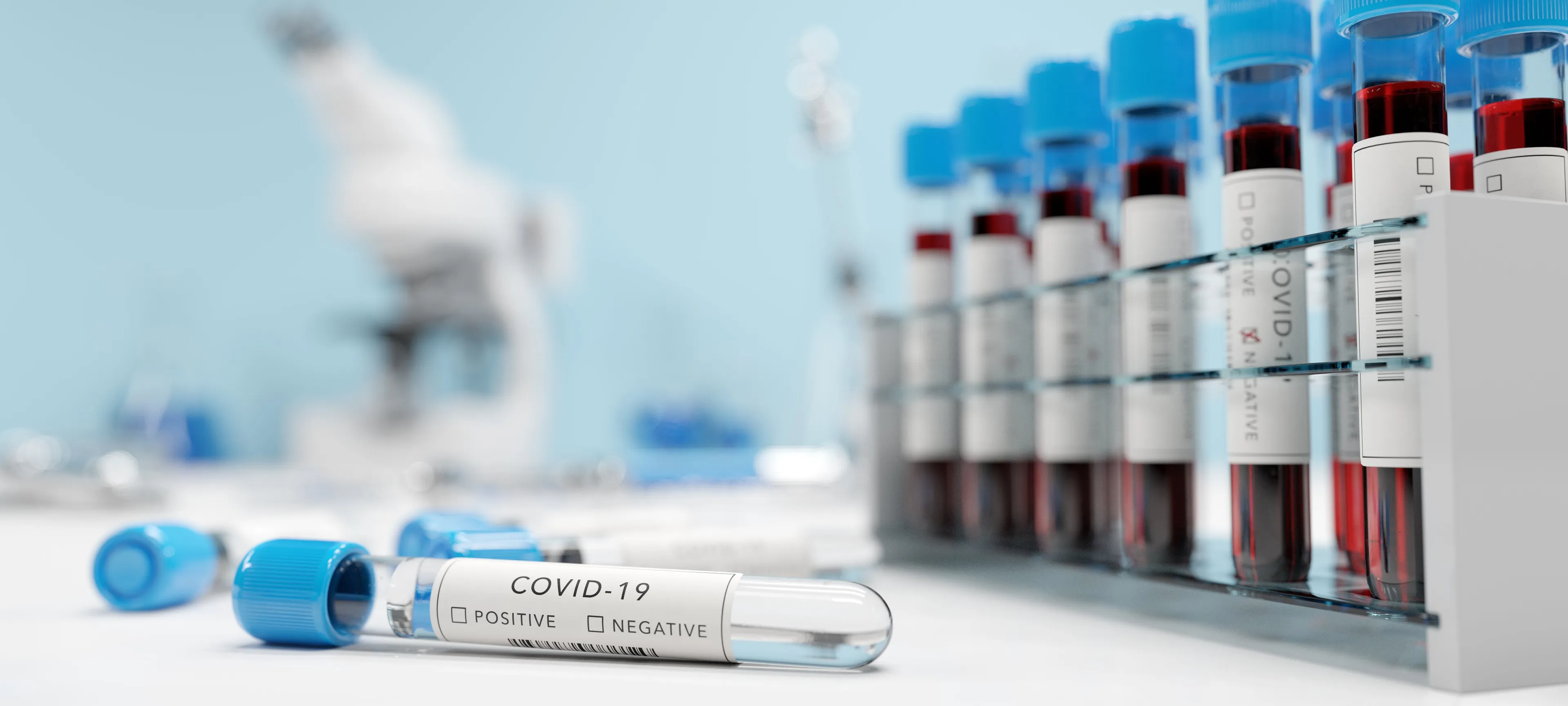 testing for coronavirus covid 19 in a lab covid me vywhu6x 50