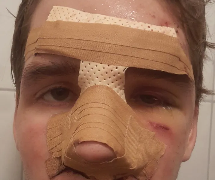 mishandeling jongen tilburg 715