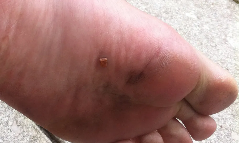 igeo40n5ao6zz1fgxl3i6u2rb img3260 e1392817829993