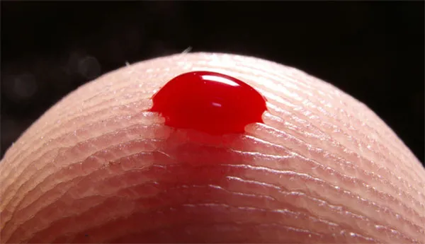 wzd03p9wfzrm1z7owd0g26217 bloed