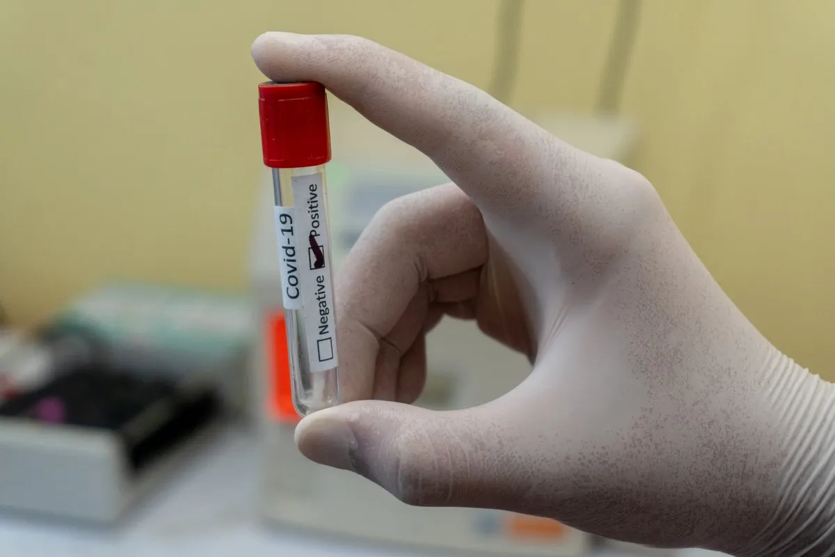 prasesh shiwakoti lomash mohihqdmuyy unsplash