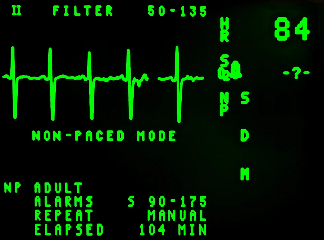 electrocardiogram 16948 1280