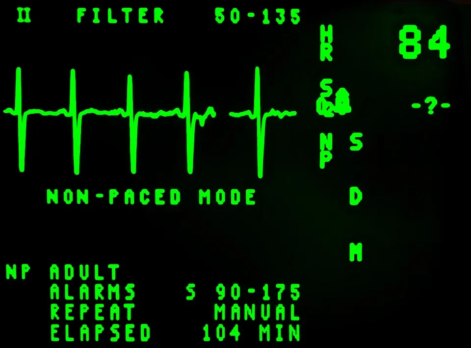 electrocardiogram 16948 960 720