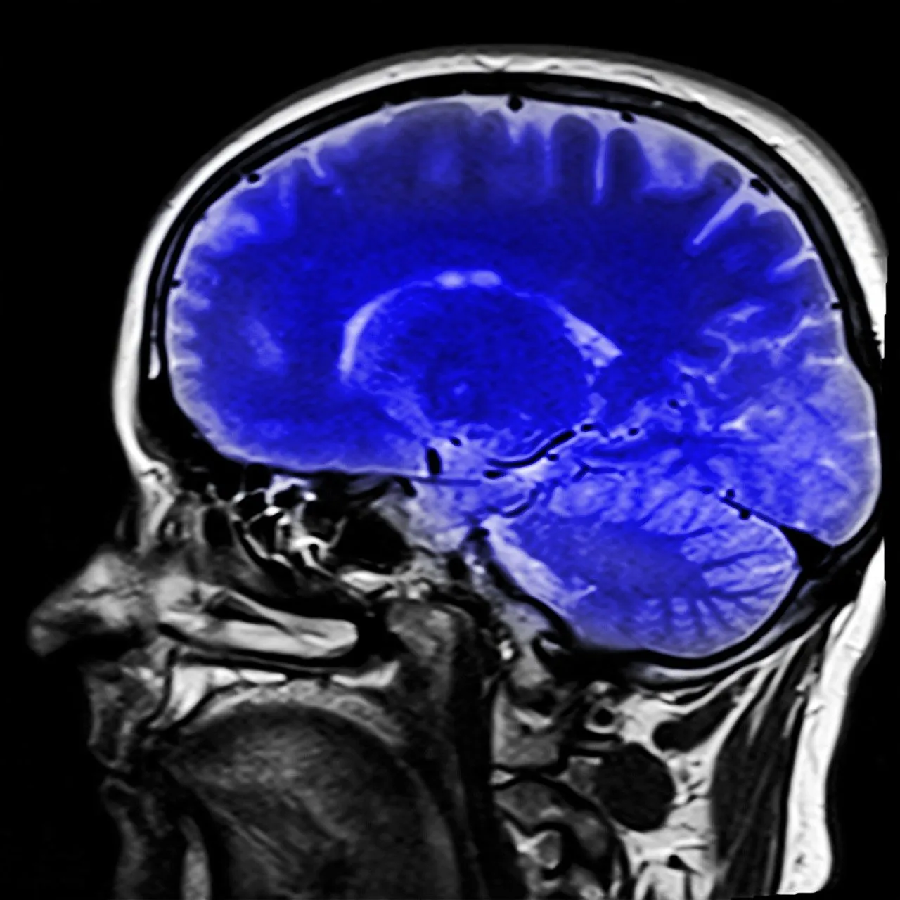 head ga3463e7eb 1280