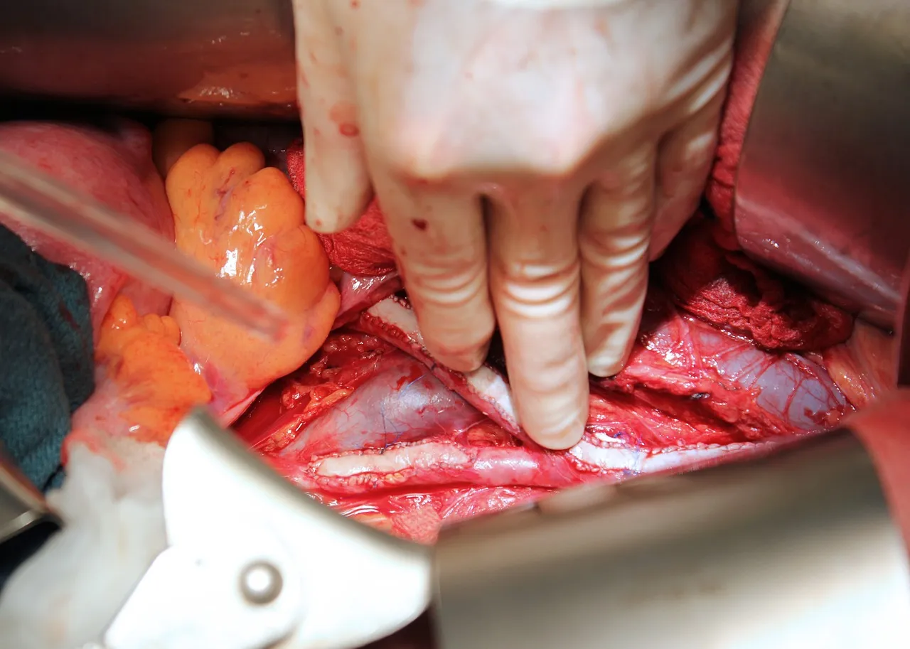 vascular surgery 1049536 1280 2