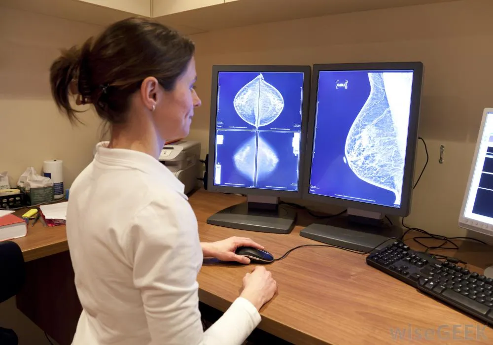 doctor examining breast x rays