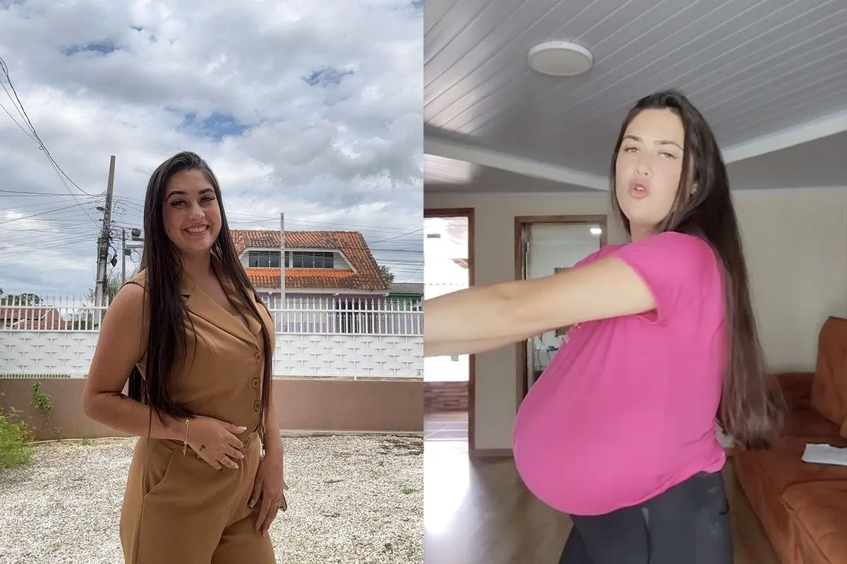 thumb vk 21 jarige vrouw uit brazilie ondergaat een gigantische borstverkleining