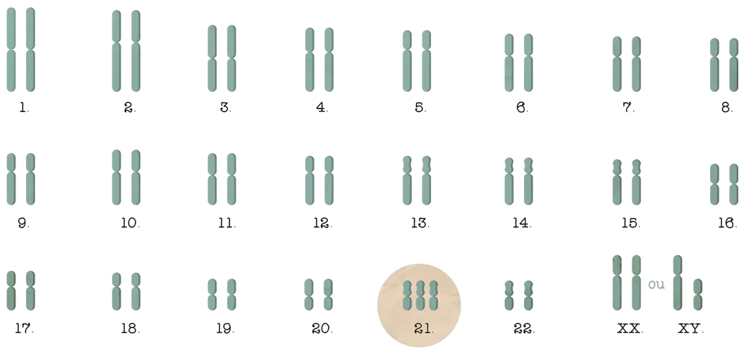 trisomie 21