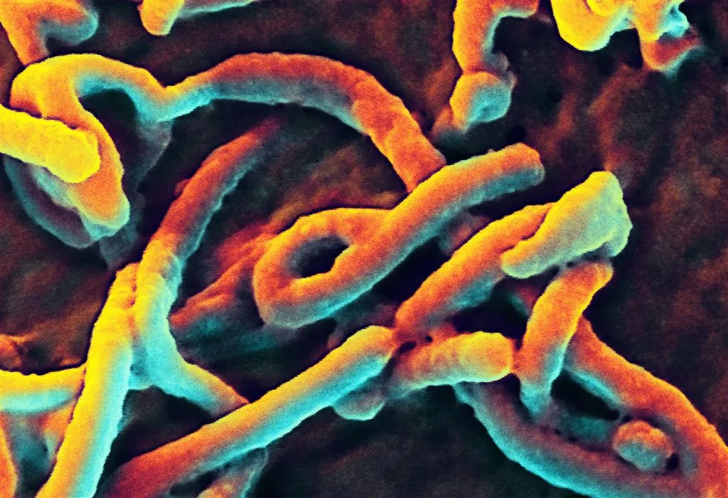 ebola mogelijk opgedoken in zweden1409534167