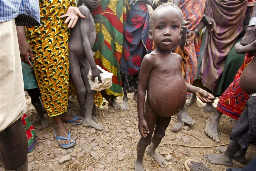 half miljoen kinderen met honger in afrika1471522854