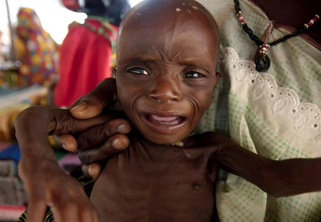 kwart miljoen kinderen ondervoed in nigeria1468900094