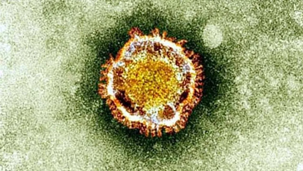 le coronavirus vu au microscope 373230