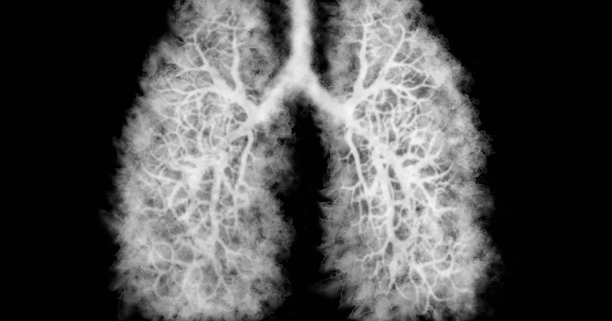 popcorn lung 1200x630 f