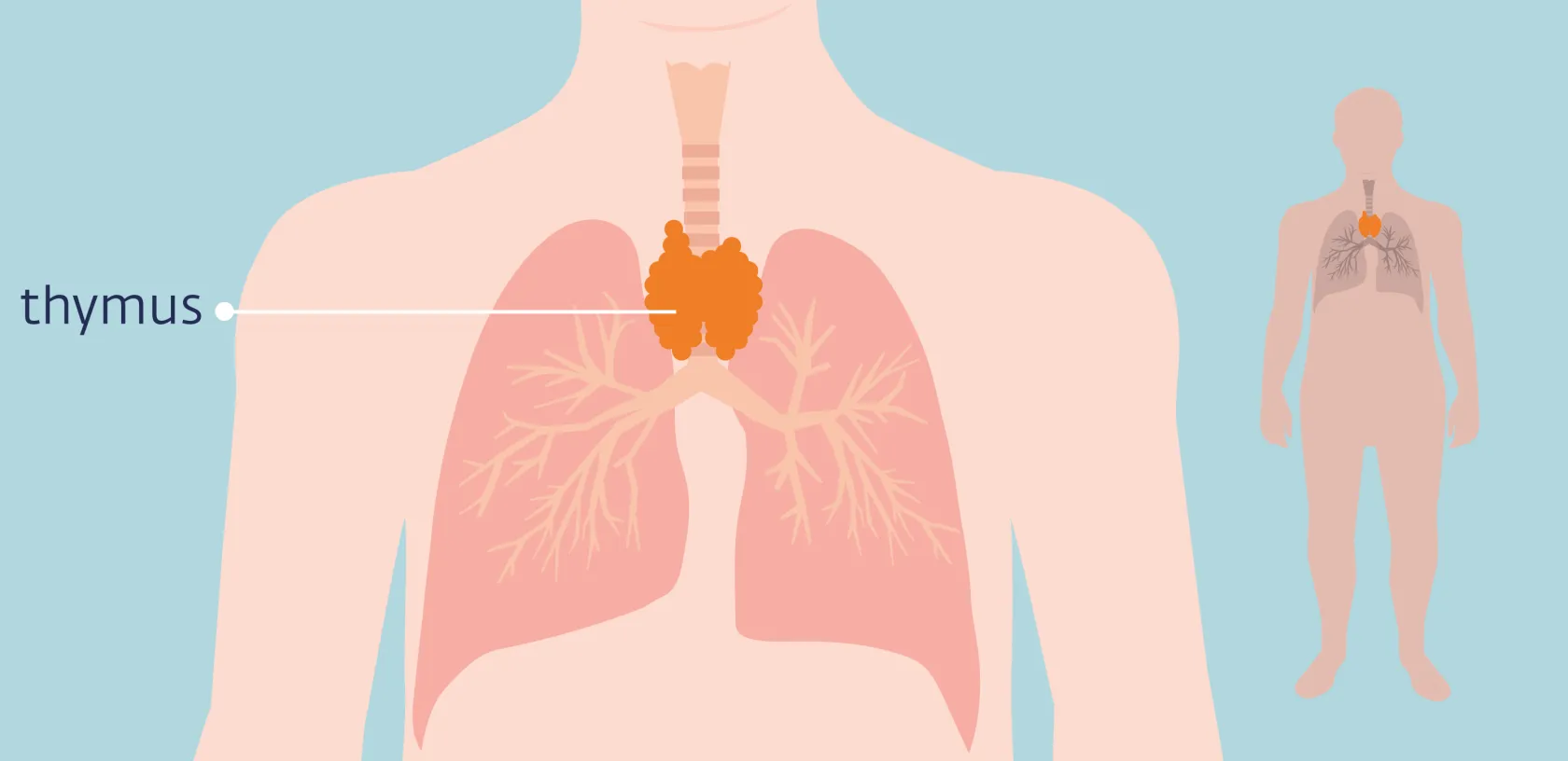 Thymuskanker_de thymus_AS_2024