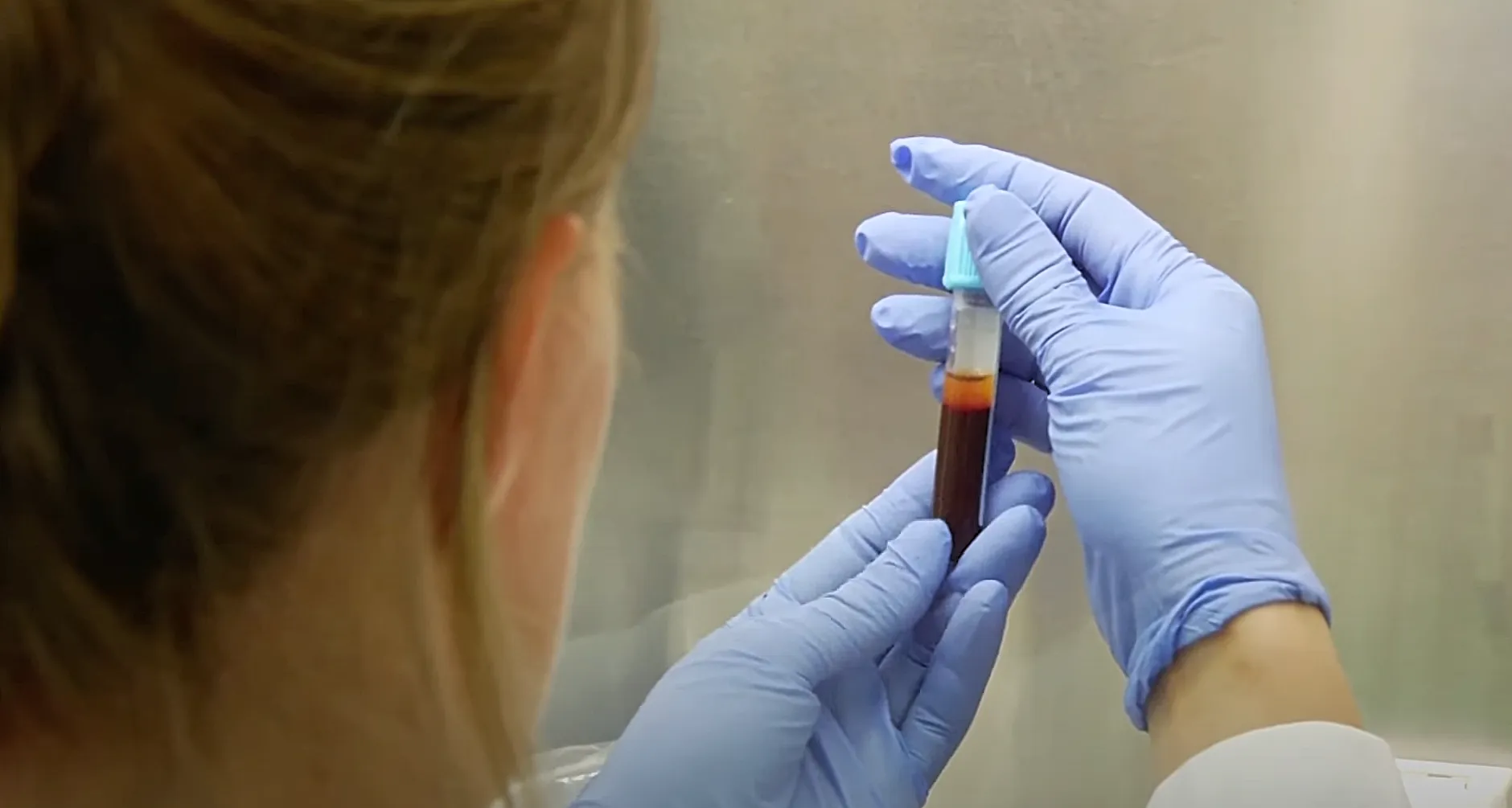 q koorts onderzoekschermafbeelding 2024 03 05 om 10