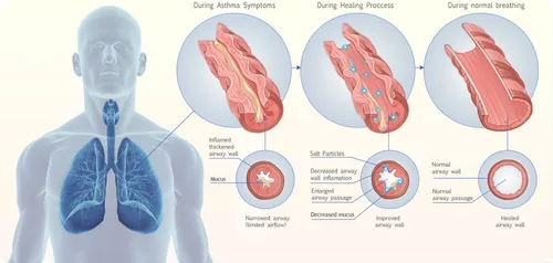 haloclinic werkwijze therapie2