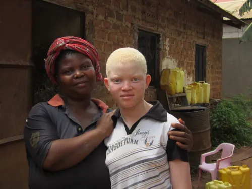 jonge dame met albinisme heeft recht op bescherming