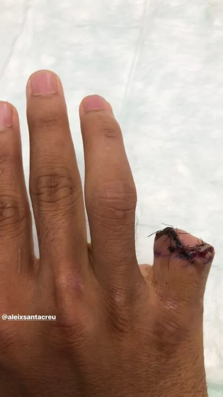 118592026 3341892919369069 1480479775268081842 n e1598912845296