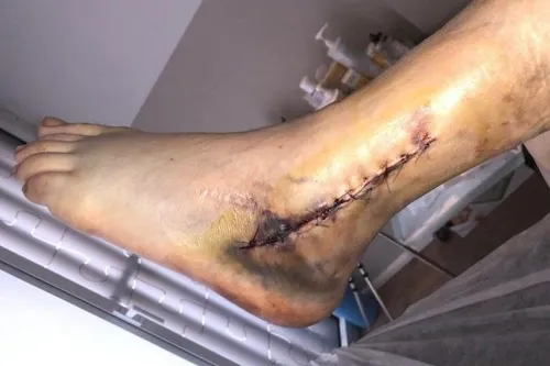 ccc84d40d89243958fc38ef43c453e81 e1549874870631