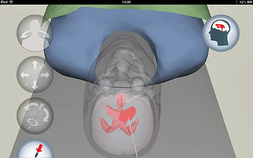 gratis-ipad-app-helpt-neurochirurgen-met.jpg