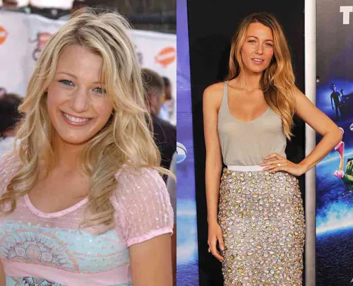 20 celebs who make us want to get plastic surgery 4