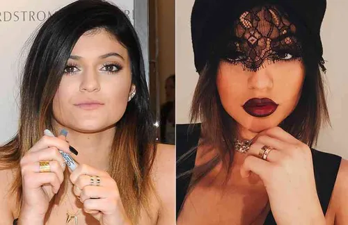 20 celebs who make us want to get plastic surgery