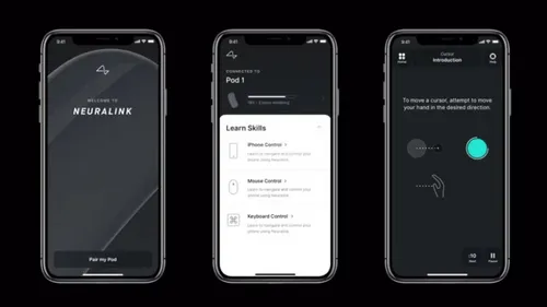 fhm neuralink 02
