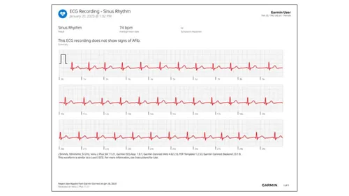 ecg recording on garmin watch