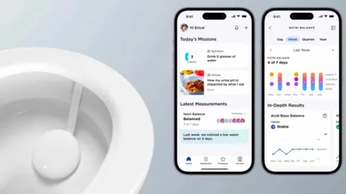 withings u scan pee sensor