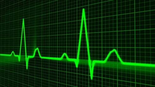 heart cardiogram