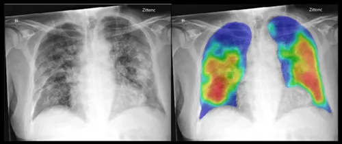 20200612 onderzoek ai covid 19