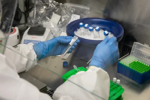 Koronavirusas, vakcina, laboratorija, tyrimai