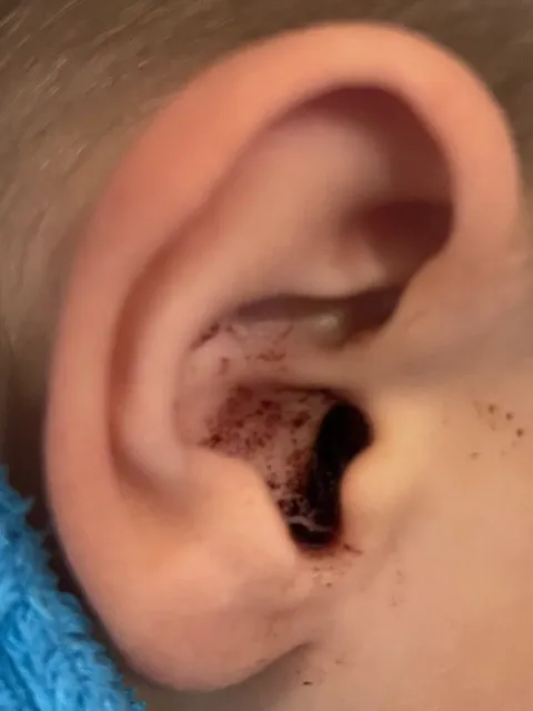 ausies fotonuotrauka copy