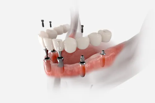 f75d6418a3f0e66805caad2de51064dc scaled