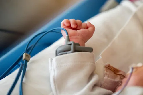 Kūdikis, Šeimos-naujagimių intensyviosios terapijos palata / Kauno klinikų nuotr.