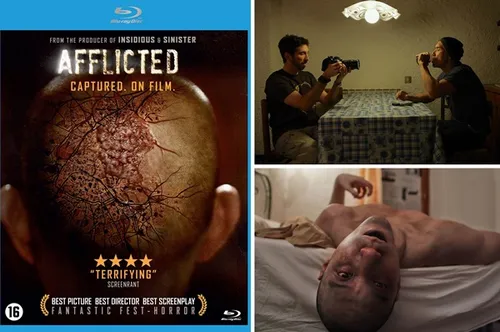 week204620 20afflicted